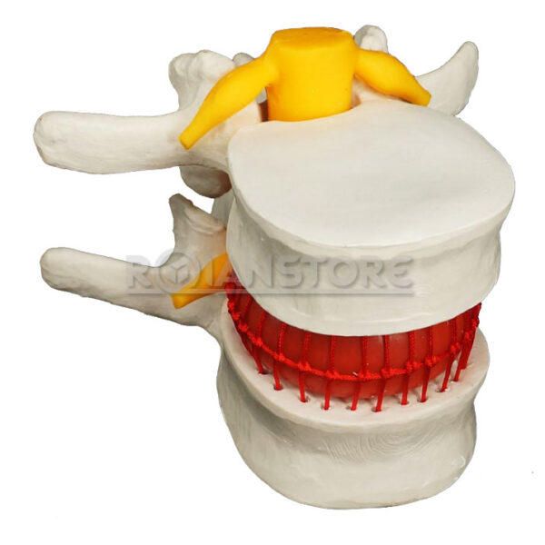 Modelo Anatómico Disco Lumbar Espina Dorsal