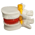 Modelo Anatómico Disco Lumbar Espina Dorsal - Imagen 6