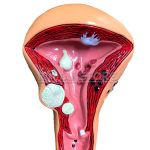 Modelo Anatomico de Ovario de Utero con patologias Con Base - Imagen 3