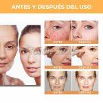 Acido Glicolico Eelhoe 7% Exfoliante Facial Solucion 100ml - Imagen 3