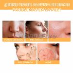 Acido Glicolico Eelhoe 7% Exfoliante Facial Solucion 100ml - Imagen 4